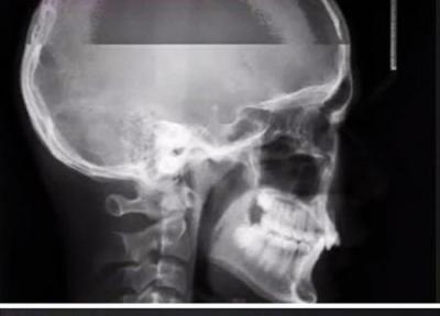 گاهی چیز های عادی هم ما را گیج می کند! گاهی چیز های عادی هم ما را گیج می کند!